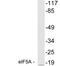 Eukaryotic Translation Initiation Factor 5A antibody, A01727-1, Boster Biological Technology, Western Blot image 