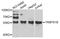 TRNA Methyltransferase 61B antibody, A12682, Boster Biological Technology, Western Blot image 