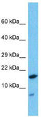 HD Domain Containing 2 antibody, TA344256, Origene, Western Blot image 