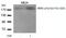 ERBB2 antibody, 79-442, ProSci, Western Blot image 