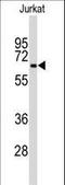 Beclin 1 antibody, LS-C156793, Lifespan Biosciences, Western Blot image 