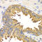 DExD/H-Box Helicase 58 antibody, LS-C331000, Lifespan Biosciences, Immunohistochemistry paraffin image 