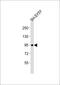 Prospero Homeobox 1 antibody, M01985-2, Boster Biological Technology, Western Blot image 