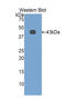 Selectin E antibody, LS-C300540, Lifespan Biosciences, Western Blot image 