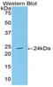 Acetylcholinesterase antibody, LS-C292354, Lifespan Biosciences, Western Blot image 