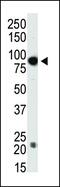 DNA Methyltransferase 3 Beta antibody, PA5-11161, Invitrogen Antibodies, Western Blot image 