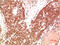 Protein Kinase AMP-Activated Catalytic Subunit Alpha 1 antibody, GTX34142, GeneTex, Immunohistochemistry paraffin image 