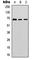 Interferon-induced guanylate-binding protein 1 antibody, abx133177, Abbexa, Western Blot image 