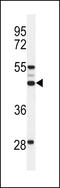 Solute Carrier Family 51 Alpha Subunit antibody, 64-141, ProSci, Western Blot image 