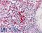 Talin 1 antibody, LS-B4430, Lifespan Biosciences, Immunohistochemistry paraffin image 