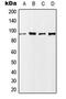 Nibrin antibody, GTX32339, GeneTex, Western Blot image 