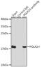 RNA polymerase II RBP8 antibody, GTX66488, GeneTex, Immunoprecipitation image 