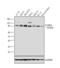 Interleukin 20 Receptor Subunit Alpha antibody, PA1-41167, Invitrogen Antibodies, Western Blot image 