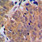 Cyclin Dependent Kinase Inhibitor 2C antibody, LS-C351980, Lifespan Biosciences, Immunohistochemistry paraffin image 
