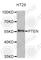 Phosphatase And Tensin Homolog antibody, A5518, ABclonal Technology, Western Blot image 