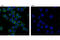 CD49D antibody, 8440S, Cell Signaling Technology, Immunocytochemistry image 
