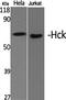 HCK Proto-Oncogene, Src Family Tyrosine Kinase antibody, A01073, Boster Biological Technology, Western Blot image 