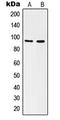 Integrin Alpha V Beta 6 antibody, LS-C352390, Lifespan Biosciences, Western Blot image 