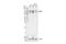 RNA Binding Motif Protein 10 antibody, 30774S, Cell Signaling Technology, Western Blot image 