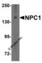 NPC Intracellular Cholesterol Transporter 1 antibody, 5185, ProSci, Western Blot image 