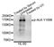 ALK Receptor Tyrosine Kinase antibody, A00301Y1096, Boster Biological Technology, Western Blot image 