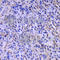 Deoxythymidylate Kinase antibody, A6370, ABclonal Technology, Immunohistochemistry paraffin image 
