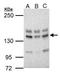 Ubiquitin Specific Peptidase 7 antibody, GTX125894, GeneTex, Western Blot image 