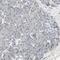 Alkaline Phosphatase, Biomineralization Associated antibody, NBP1-91659, Novus Biologicals, Immunohistochemistry paraffin image 