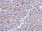 Ribonucleotide Reductase Regulatory TP53 Inducible Subunit M2B antibody, NBP2-19668, Novus Biologicals, Immunohistochemistry paraffin image 