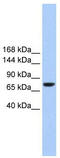 Transmembrane Channel Like 2 antibody, TA342093, Origene, Western Blot image 