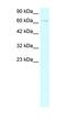 Zinc Finger And BTB Domain Containing 20 antibody, orb324390, Biorbyt, Western Blot image 