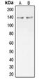 Collagen Type XX Alpha 1 Chain antibody, MBS820394, MyBioSource, Western Blot image 