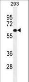 PAT1 Homolog 2 antibody, LS-C163382, Lifespan Biosciences, Western Blot image 