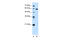 T-Box 15 antibody, 30-316, ProSci, Western Blot image 