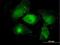 Myristoylated Alanine Rich Protein Kinase C Substrate antibody, H00004082-M06, Novus Biologicals, Immunocytochemistry image 