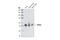 Parkin RBR E3 Ubiquitin Protein Ligase antibody, 4211T, Cell Signaling Technology, Western Blot image 