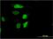 Retinol Dehydrogenase 12 antibody, MA5-24524, Invitrogen Antibodies, Immunofluorescence image 