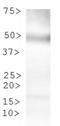 Tryptophan Hydroxylase 2 antibody, TA336836, Origene, Western Blot image 