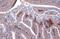 Heat Shock Protein Family B (Small) Member 1 antibody, GTX634459, GeneTex, Immunohistochemistry paraffin image 