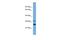 Proline And Serine Rich 2 antibody, A15218, Boster Biological Technology, Western Blot image 