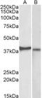 NME1 antibody, 43-626, ProSci, Western Blot image 