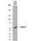 Serpin Family A Member 7 antibody, MAB8176, R&D Systems, Western Blot image 