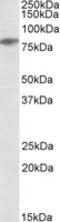 Lymphocyte Cytosolic Protein 2 antibody, MBS421277, MyBioSource, Western Blot image 