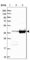 Calponin 3 antibody, NBP2-38643, Novus Biologicals, Western Blot image 