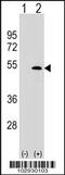Lymphatic Vessel Endothelial Hyaluronan Receptor 1 antibody, 60-901, ProSci, Western Blot image 