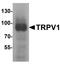 Transient Receptor Potential Cation Channel Subfamily V Member 1 antibody, LS-C201028, Lifespan Biosciences, Western Blot image 