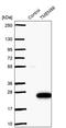 Transmembrane Protein 88 antibody, PA5-62712, Invitrogen Antibodies, Western Blot image 