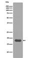 Ubiquitin Conjugating Enzyme E2 I antibody, M02295, Boster Biological Technology, Western Blot image 