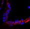 EGFR antibody, IHC-00005, Bethyl Labs, Immunohistochemistry paraffin image 