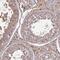 Glutamate dehydrogenase antibody, NBP2-54700, Novus Biologicals, Immunohistochemistry frozen image 